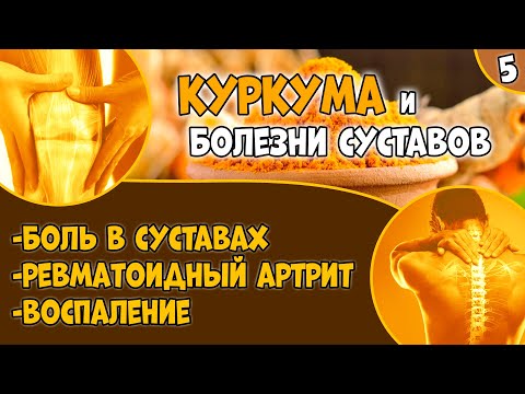 КУРКУМА (видео 5): болезни суставов (ревматоидный артрит, остеоартроз, хондроз).