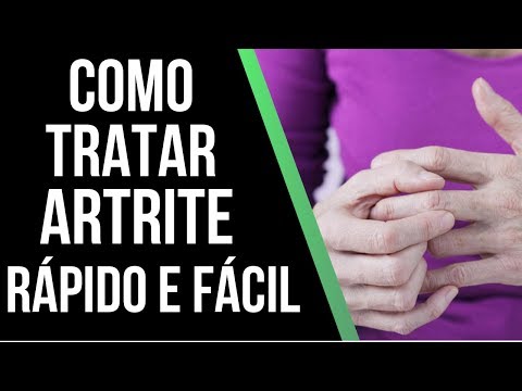 Como Tratar a Artrite de Maneira RÁPIDO E FÁCIL QUE A INDUSTRIA ESCONDE