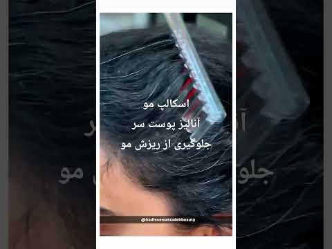 سالن زیبایی نعمت زاده از بهترین دستگاه ها برای درمان پوست سر و ریزش موی سر درخدمت شما عزیزان هستیم