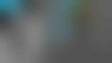 Shell technique with maxgraft® cortico - live surgery by Dr. Jan Kielhorn