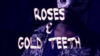 2Shots - Roses And Gold Teeth Official Music Video