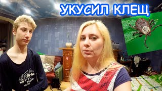 МЕНЯ УКУСИЛ КЛЕЩ  ЕСЛИ Б НЕ СЫН НЕ ЗНАЮ, ЧТО ДЕЛАЛА БЫ ?‍