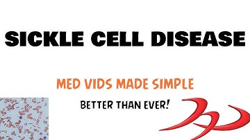Sickle cell disease | Hemolytic anemia | Pathology, Clinical features, Complications and Treatment