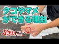 足裏にタコやマメができる原因と治し方　｜京都市北区　もり鍼灸整骨院