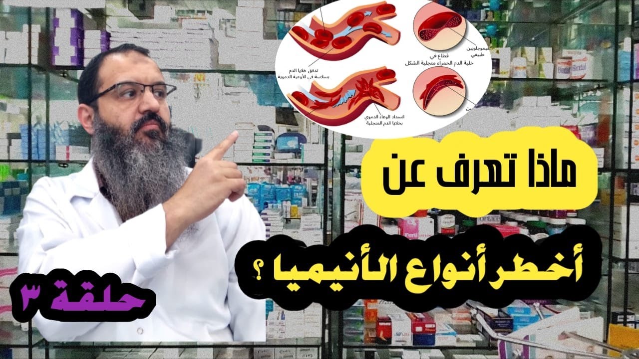 سلسلة وصفات وعلاجات في الصميم -18- تعرف على أخطر أنواع فقر الدم ( الأنيميا ) / فقر الدم المنجلي