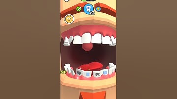 Teeth Braces #dentist #shorts #cartoon