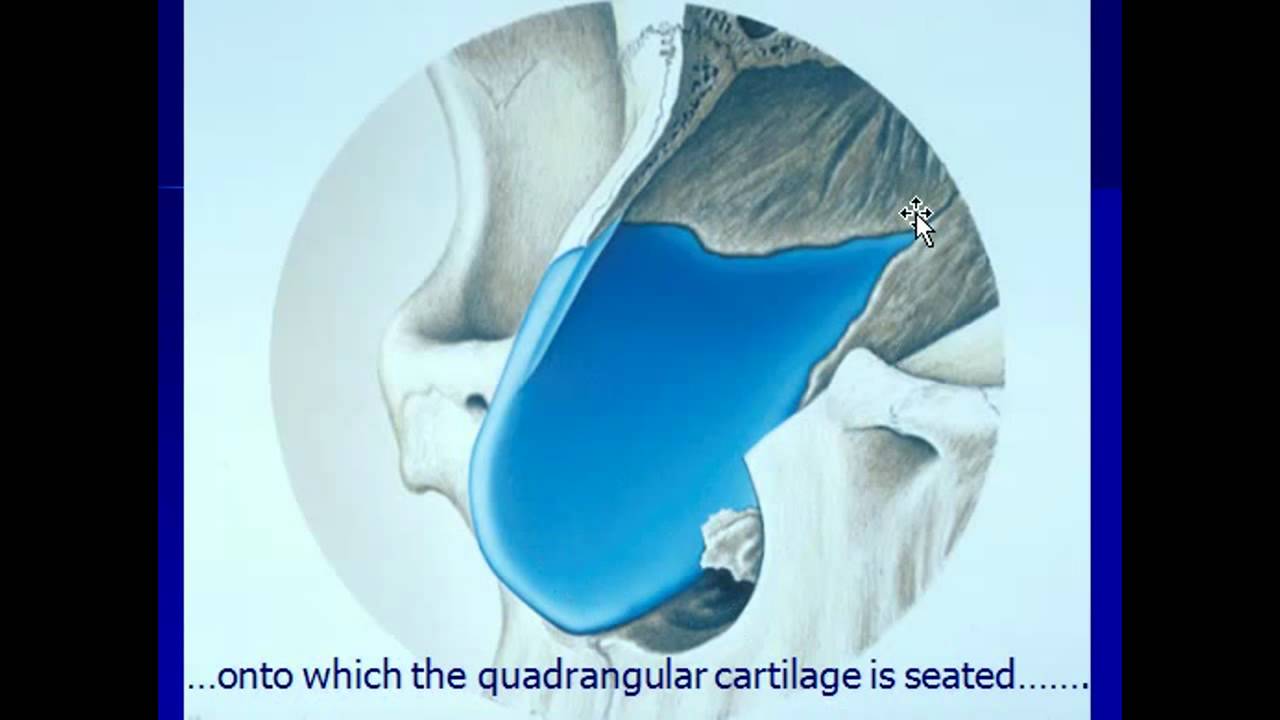 Rhinoplasty - The Structural Approach - Part 3 - YouTube