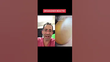 BIGGEST BLISTER I VE SEEN Shorts Cyst Podiatry Blister 
