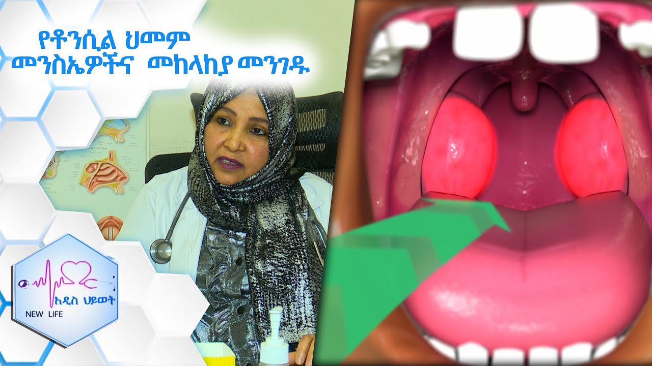 የቶንሲል ሕመምን በቀላሉ የመከላከያ መንገዶች፡፡  NEW LIFE EP 317