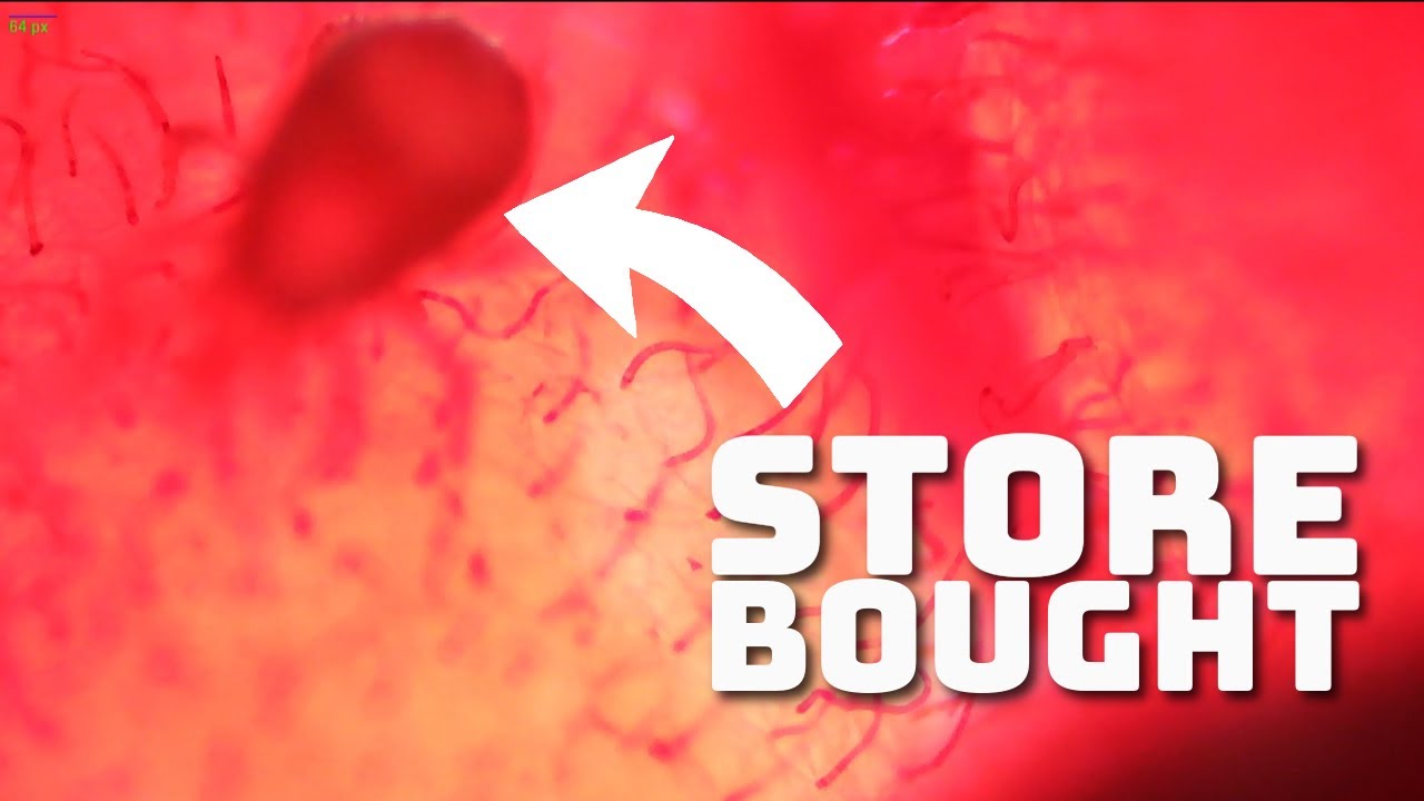 Raspberries Under the Microscope - YouTube