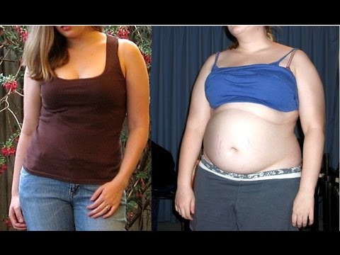 HUGE Weight Gain of 70 LBS - Before & After
