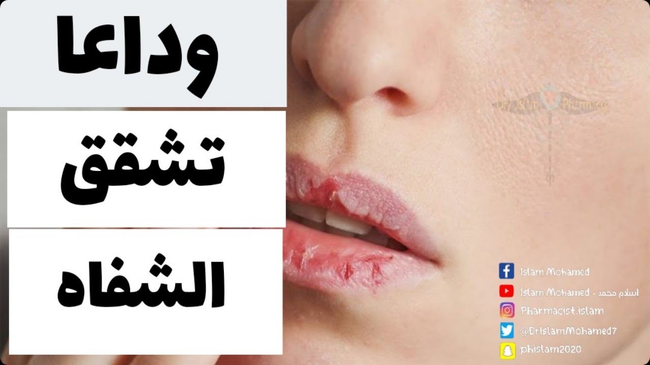 اعراض جفاف الشفتين , ما هي علامات المشاكل الصحية بالجسم التي تظهر على ...