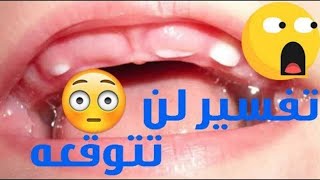 تفسير ظهور الاسنان في المنام - تفسير شامل