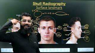 Skull Surface Landmark and Lines || Part -1 || Radiographic Technique || Radiography Made Easy ||