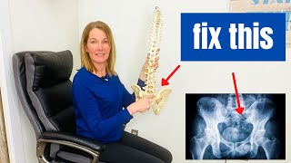 SI Joint Dysfunction | Symptoms and Fixes