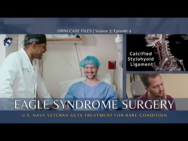 Eagle Syndrome Surgery / Styloidectomy Treatment for U.S Navy Veteran Suffering With Extreme Pain