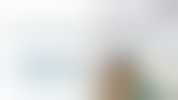 Robotic Gastric GIST Resection + Robotic Cholecystectomy (CT Scan Included)  - da Vinci Xi