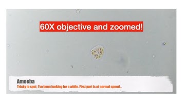 Amoeba under the microscope with Raspberry Pi HQ Camera