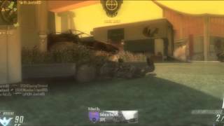 My OCE