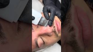 Men’s Nose Extractions