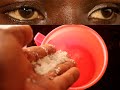 Eye Disease Prevention Tips I Taasa Amaaso gwo Kubulwadde bwa Red Eyes
