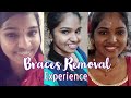 🦷🔥Braces Remove ചെയ്തപ്പോഴുള്ള എന്റെ അനുഭവം 😌| Braces Removal