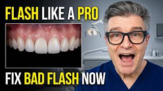Most Dentists Use Dental Flashes Wrong (Here’s Why) Most Dentists Use Dental Flashes Wrong (Here’s Why)