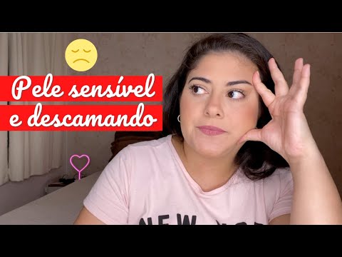 Vídeo: Como ter uma pele manchada: 10 etapas