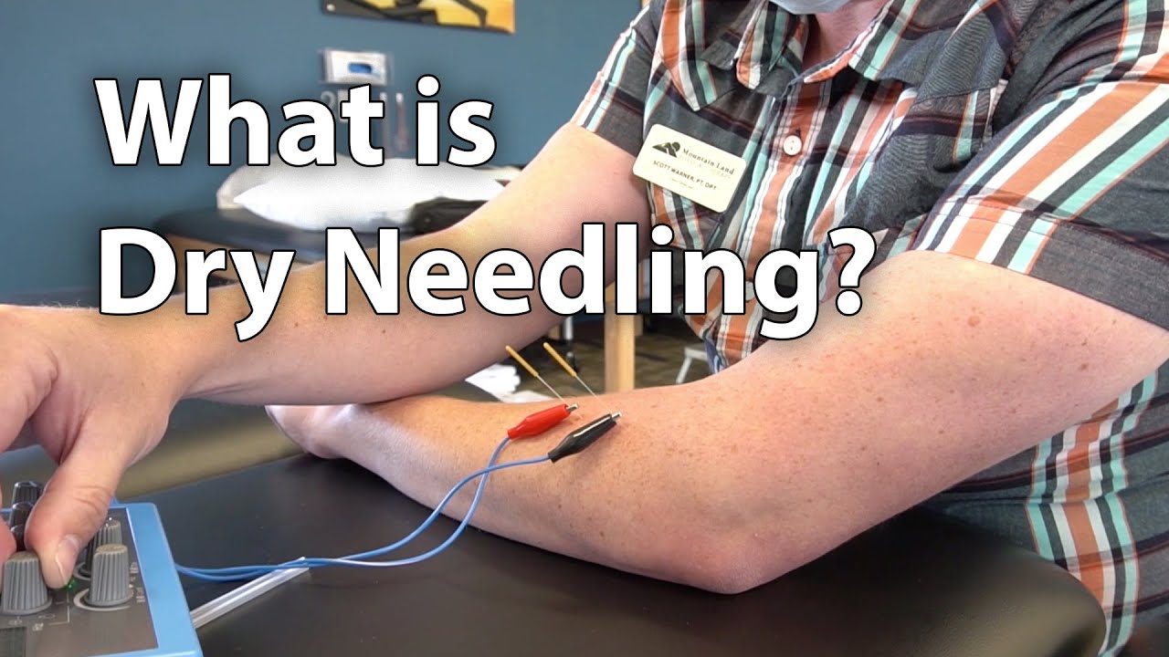 Functional Integrative Rehabilitation Education - E Stim and Needling