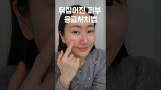 속건조 잡는 보습크림 추천 (닥터벨머 시카크림)#시카크림 #보습크림 #크림추천