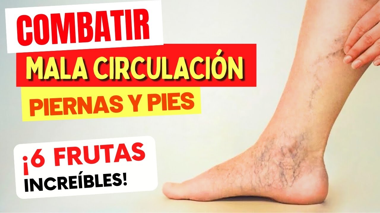 6 FRUTAS para COMBATIR la MALA CIRCULACIÓN en PIERNAS y PIES (y CÓMO USARLAS)