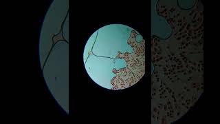 Onion root tip squash view(Magnification-X150)