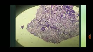 Histopathological changes in the Behcets disease