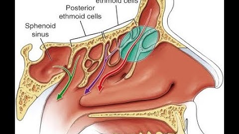Sinusotomy CPT code - simplify medical coding