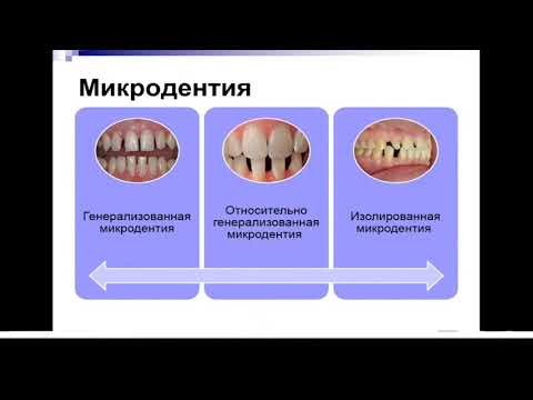 13:50 Аномалии зубов и зубных рядов
