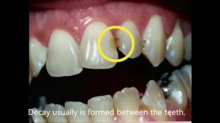 Dental care and cleaning. How to clean properly the teeth?