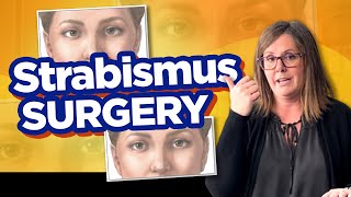 STRABISMUS SURGERY? Watch This FIRST!