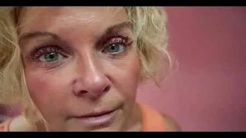 Sandra Byers talks about using Latisse for her eye...