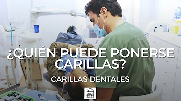 ¿Quién no debe ponerse carillas?