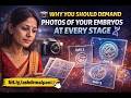 Why You Should Demand Photos Of Your Embryos At Every Stage 📸🧬 bit.ly/askdrmalpani