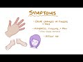 Raynaud Phenomenon - causes, symptoms, diagnosis, treatment, pathology