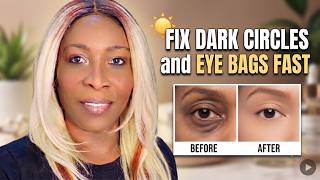 Fix Dark Circles & Eye Bags Fast (ultimate Skincare & Depuffing Guide) 📱