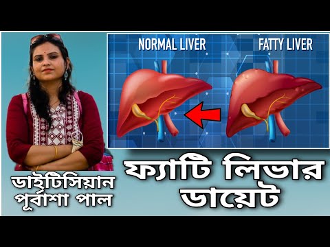 Fatty liver diet in Bengali| ফ্যাটি লিভারের সঠিক ডায়েট চার্ট। ফ্যাটি লিভার হলে কি খাবেন কি খাবেন না