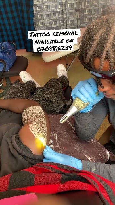 tribal-tattoo-removal-in-kenya-tattooremoval-kenya-nairobi-youtube