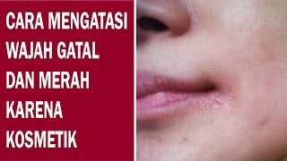 CARA MENGATASI WAJAH BENGKAK DAN MEMERAH AKIBAT PEMAKAIAN CREAM PEMUTIH