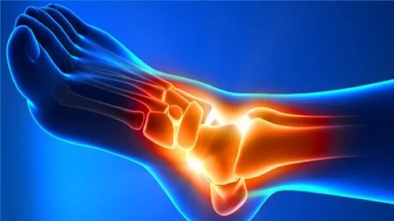 Why Does My Ankle Hurt When I Skateboard YouTube
