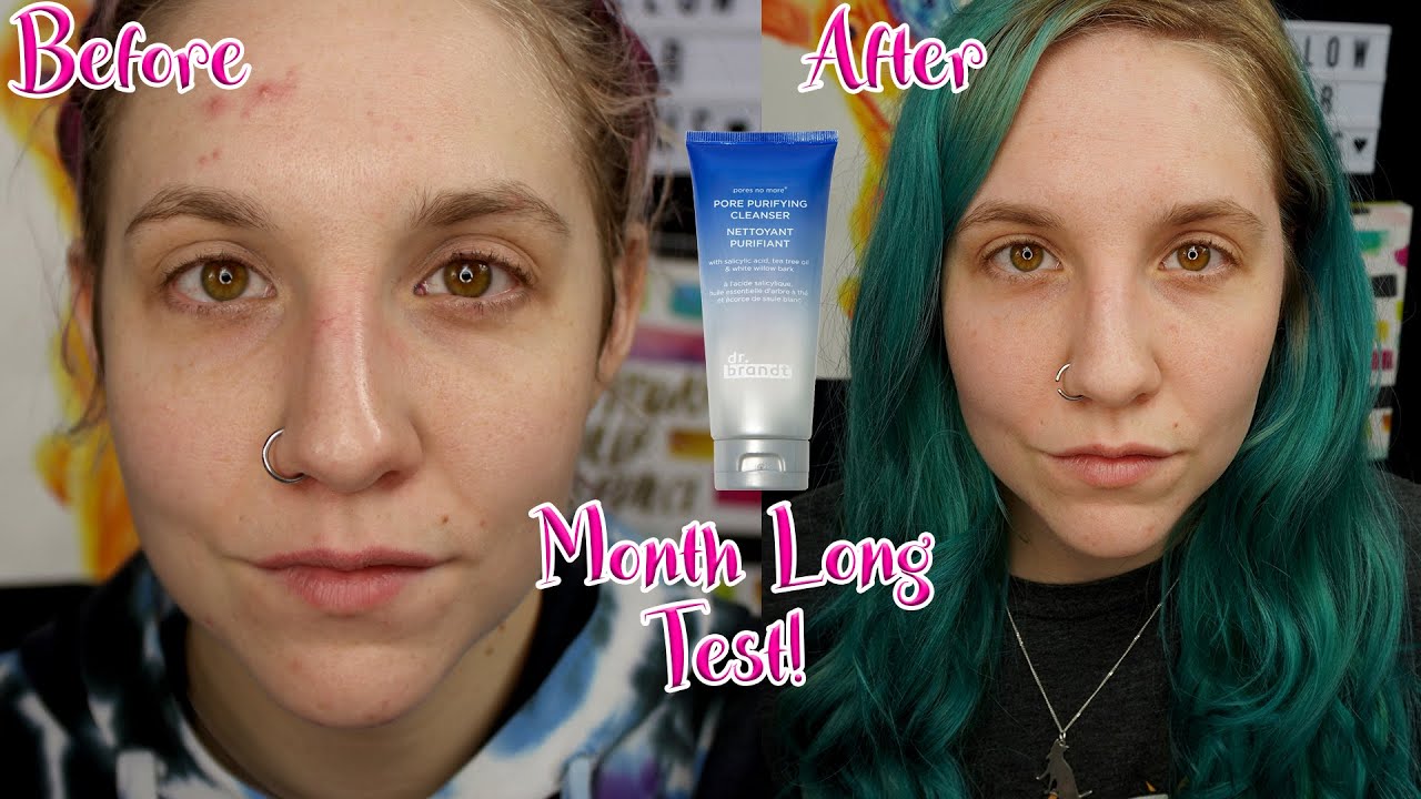 Dr. Brandt Pores No More Purifying Cleanser | Month Long Test | Before and  After Results - YouTube