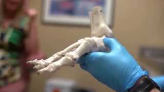 Ankle Surgery with Podiatrist Dr. Randy Lew screenshot 5