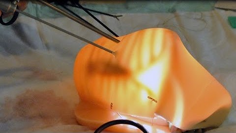 3-D Simulation Helps Surgeons Master Complex Procedures