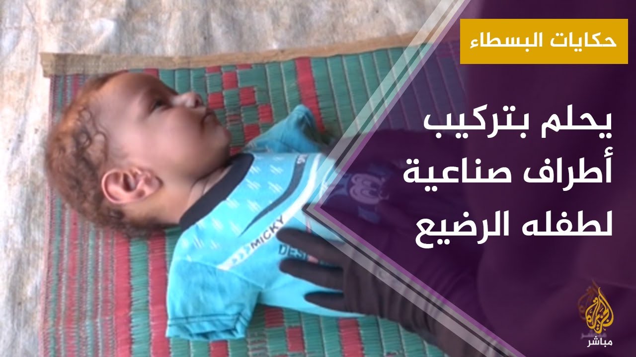حكايات البسطاء.. محمد الفاقد نازح سوري يحلم بتركيب أطراف صناعية لطفله الرضيع